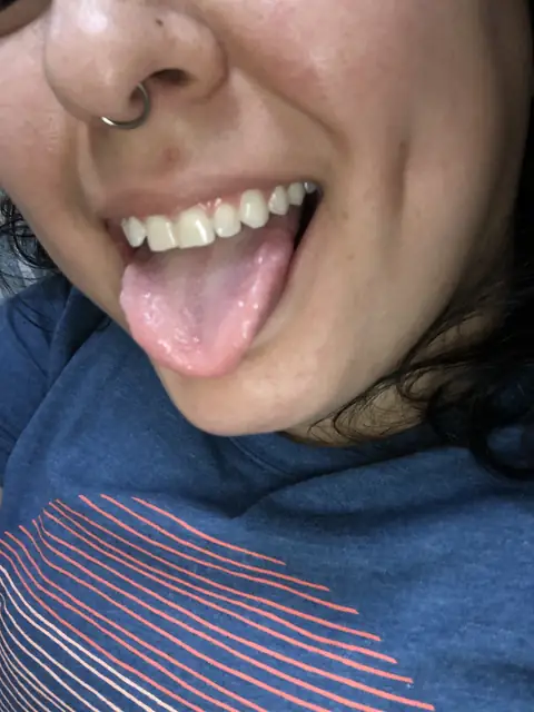 Amy