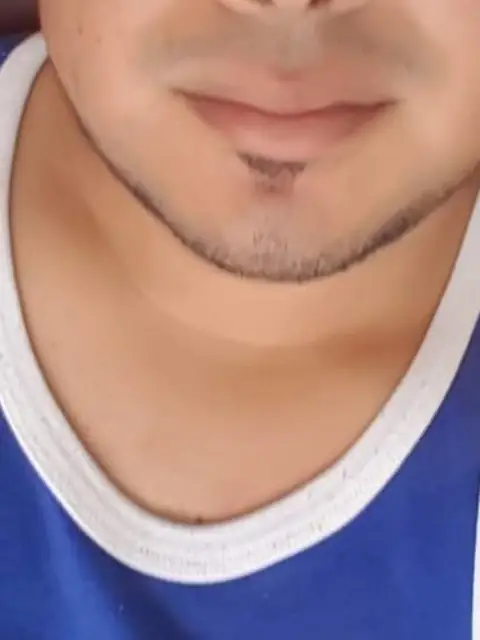 Morenazo